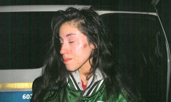 Mariah Valenzuela injuries 1